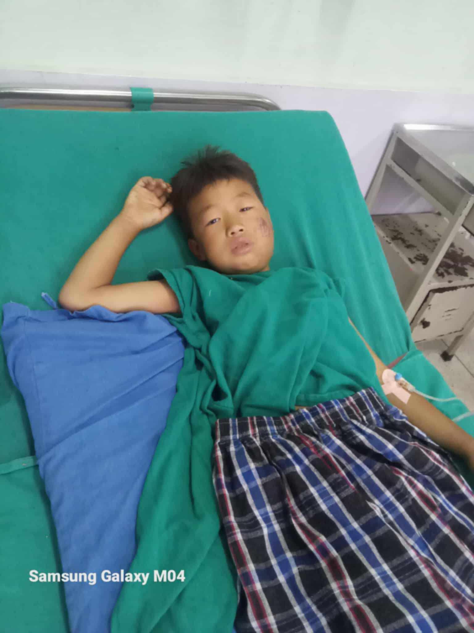 NEEF Steps In to Save the Life of Young Yuganta After Tragic Accident in Remote Nepalese Village